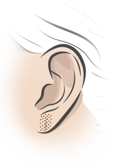 lobulo orelha